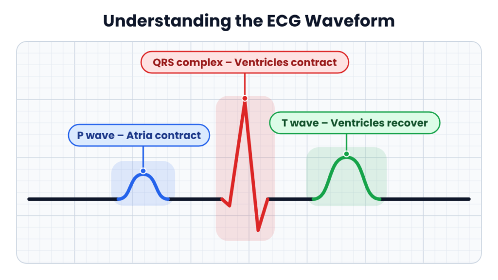 ecg-master-diagram