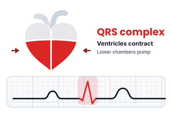 Heart with the lower chambers (ventricles) in red pumping blood out, beside an ECG trace with the QRS spike in red