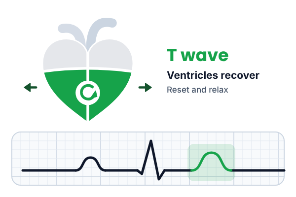 Heart with the ventricles in green showing recovery, beside an ECG trace with the T wave in green